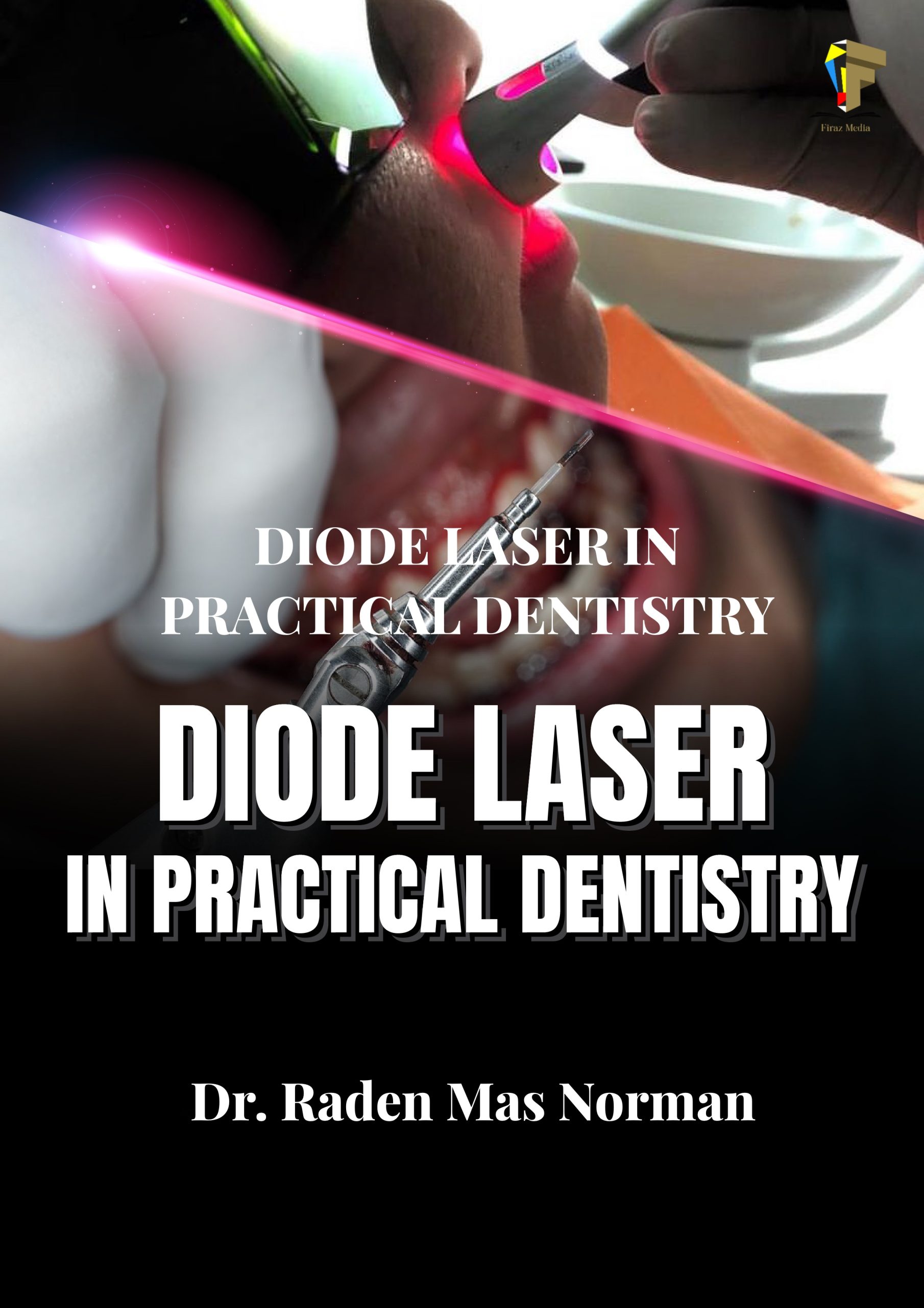 Diode Laser in Practical Dentistry